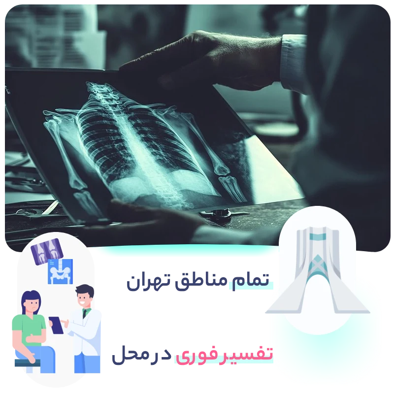 رادیولوژی در منزل تهران - گاما پرتو